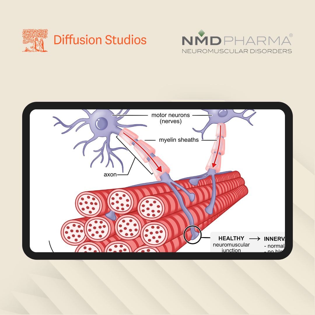 NMD Pharma Partners with Diffusion Studios